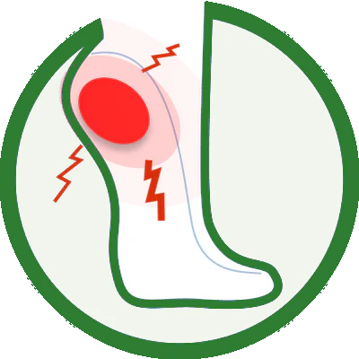 Plantar Fasciitis